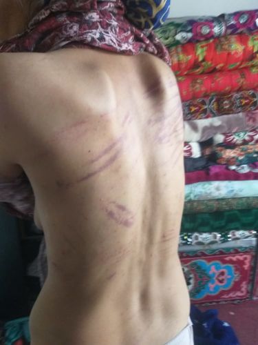 Избиение женщины в Сокулуке. Мужа пострадавшей отпустили под домашний арест