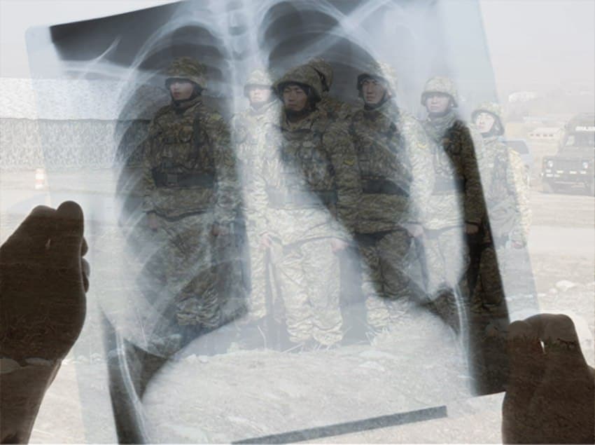 В Кыргызстане в 2022 году отмечен рост заболеваемости туберкулезом