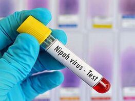 No reason for panic: Health Ministry of Kyrgyzstan on Nipah virus