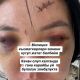 Фото из интернета. Женщина показала травмы после избиения и раскритиковала выводы экспертов