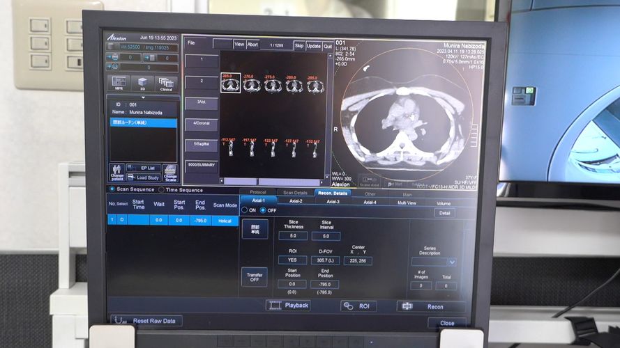 Фото пресс-центра Минздрава. В Наццентре кардиологии и терапии запущен мобильный компьютерный томограф