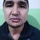 Фото Самата Мацтакова. Обвиняемый в связи с ОПГ Камчи Кольбаева зашил себе рот