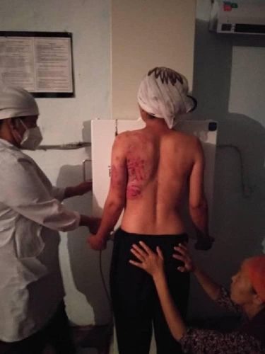 Фото УВД Джалал-Абадской области. В Аксыйском районе муж жестоко избил свою супругу