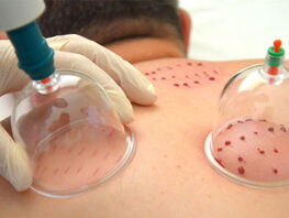 Хиджама для младенца: как вера в&nbsp;&laquo;народное лечение&raquo; привела к&nbsp;трагедии в&nbsp;Узгене
