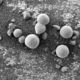 Фото NASA/Daily Mail. А так «марсианские грибы» выглядят при увеличении