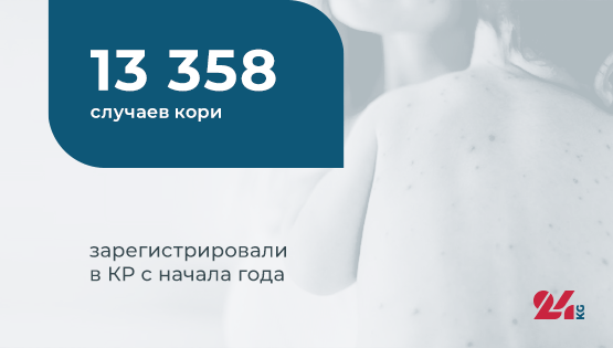 Цифра дня.&nbsp;13&nbsp;тысяч 358 случаев кори зарегистрировали в&nbsp;КР с&nbsp;начала года
