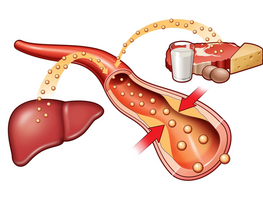 Ученые Китая нашли способ избавить людей от&nbsp;лишнего холестерина
