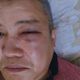 Фото потерпевшего Советбека Мурзаханова. В Бишкеке сотрудник ГКНБ избил соседа