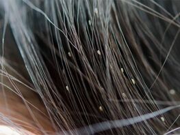 Педикулез. Чем опасны вши и&nbsp;как от&nbsp;них избавиться
