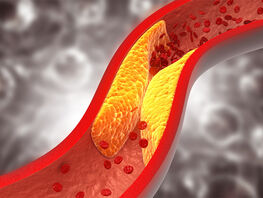 Ученые Китая нашли способ избавить людей от&nbsp;лишнего холестерина
